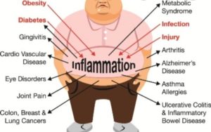 Gut Health and Autoimmune Disorders